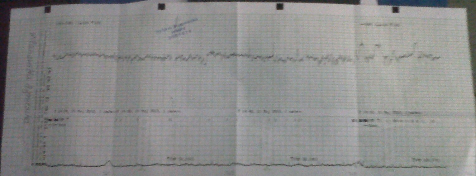 WilanFamily 37 tydzień i zaczynamy KTG