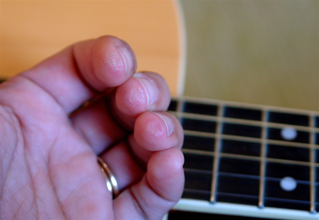 Guitar Bender Guitar Calluses Obtain Your Badge Of Honor