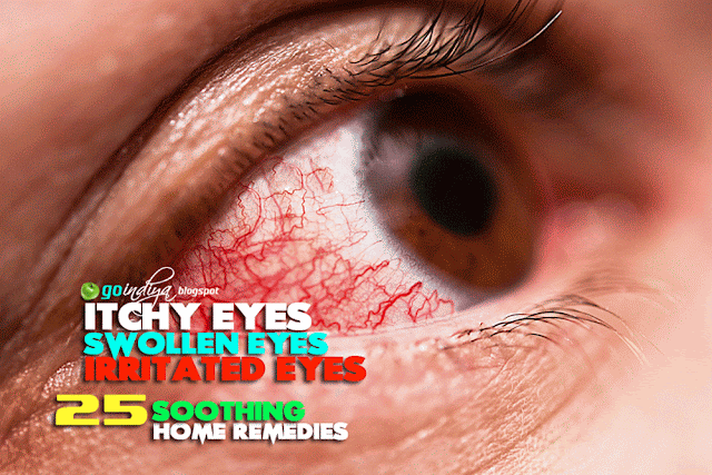 itchy burning eyes home remedy