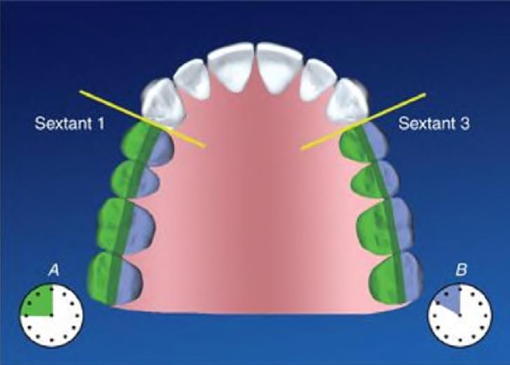 sextant of teeth dentistry lectures for mfds mjdf nbde ore principles of sextant of teeth dentistry lectures for mfds mjdf nbde ore principles of
