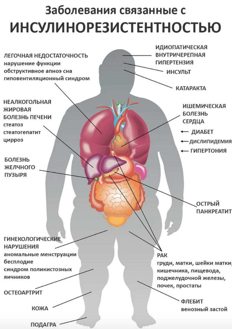 Какая Диета Подходит При Инсулинорезистентности