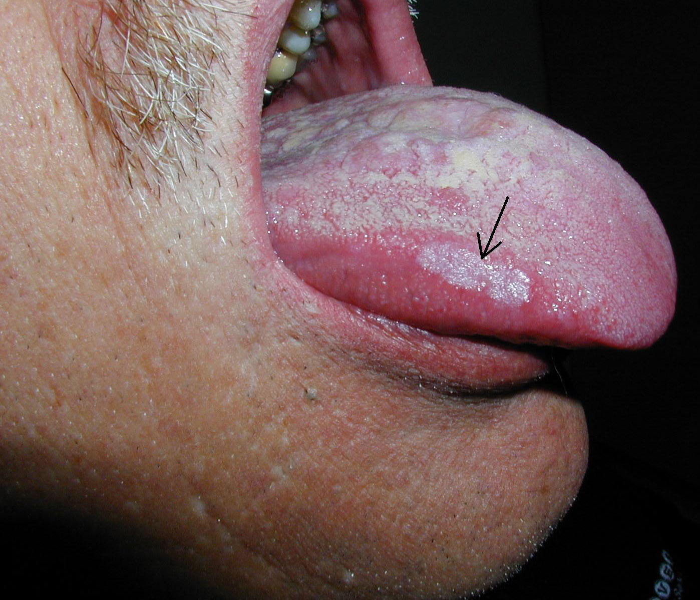 Oral Spots 13