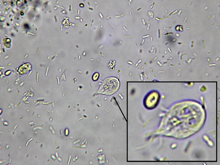 Fun With Microbiology (What's Buggin' You?) Giardia lamblia