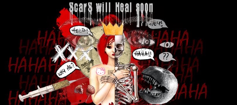 Scars will heal soon