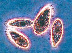 Alex.Alveo18: Vocabulary # 5 -Protist and Fungi