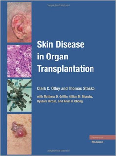 Skin Disease in Organ Transplantation Skin+disease+in+organ+transplantation