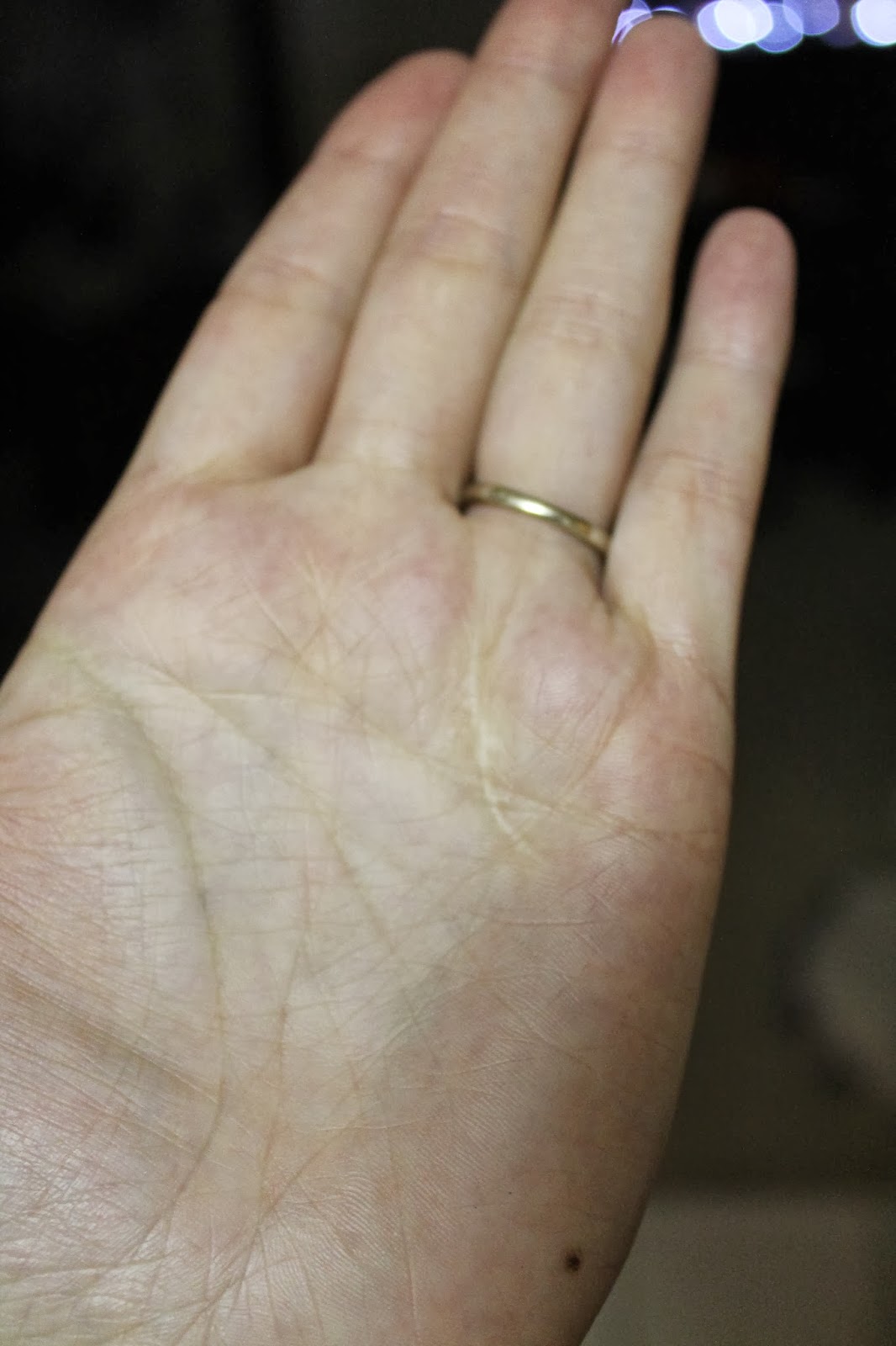 What Life Makes Of Me...And Other Fancy Stuff: Healing Scars