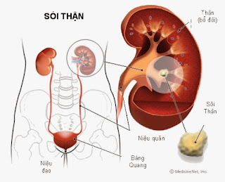 Phòng biến chứng viêm cầu thận