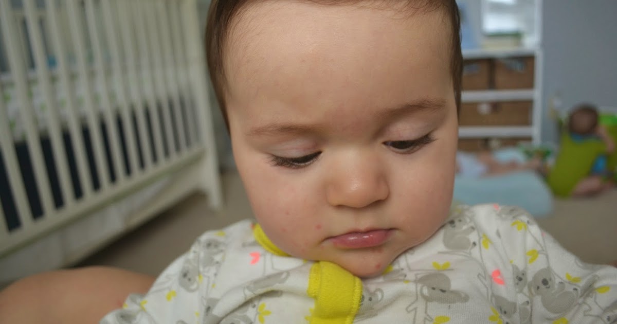 Three Peerys in a Pod HFMD