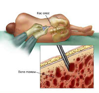 dangers of chemotherapy