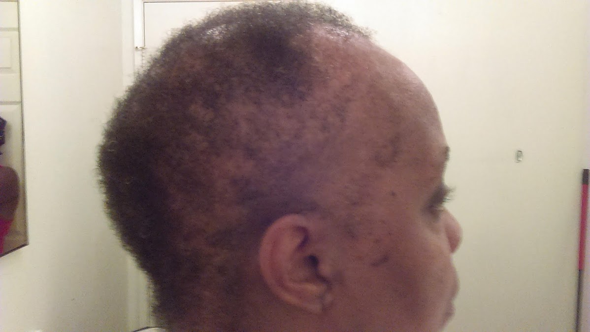 My Natural Hair 2nd Journey 2nd Month Hair Growth Update 7 8 15