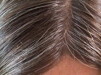 نقره لتكبير أو تصغير الصورة ونقرتين لعرض الصورة في صفحة مستقلة بحجمها الطبيعي