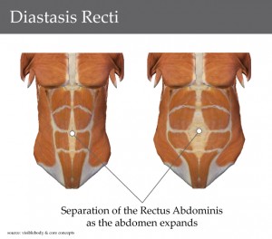 Management outcomes in pubic diastasis: our experience 