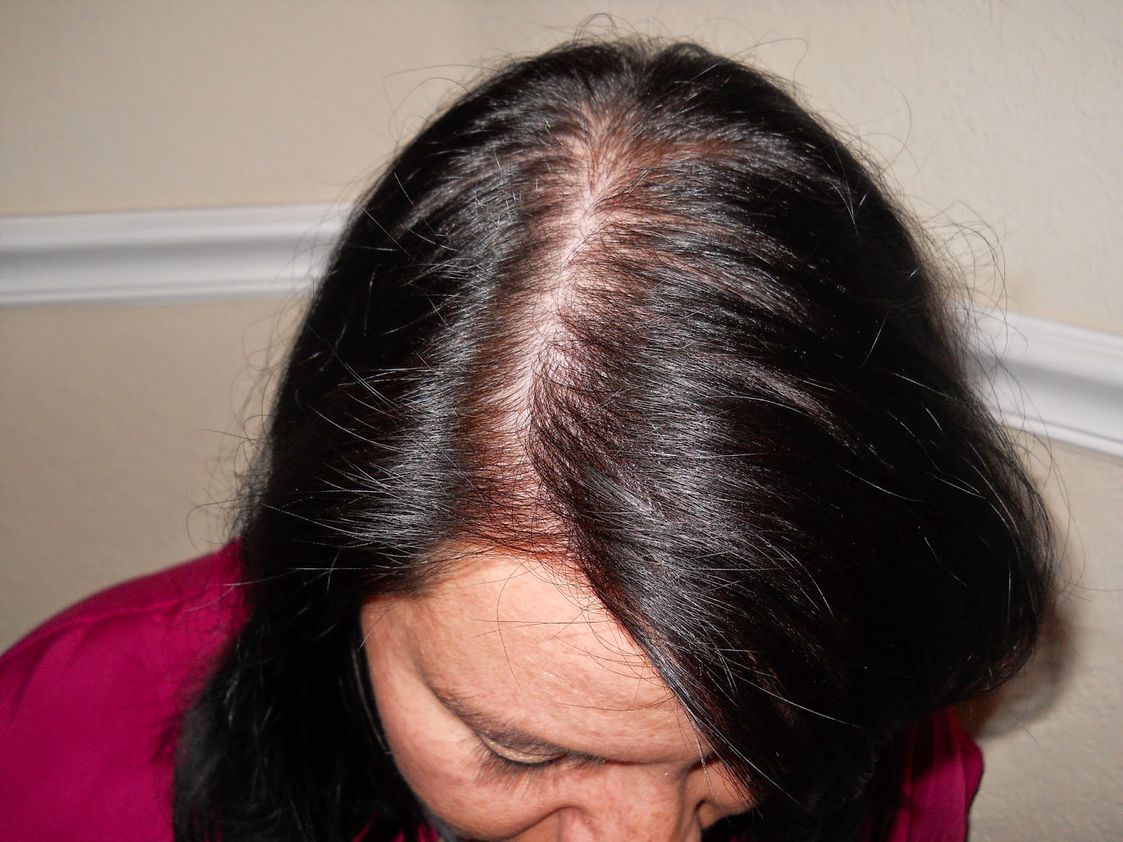 Cruztube With Angela Cruz Living With Thinning Hair Aka