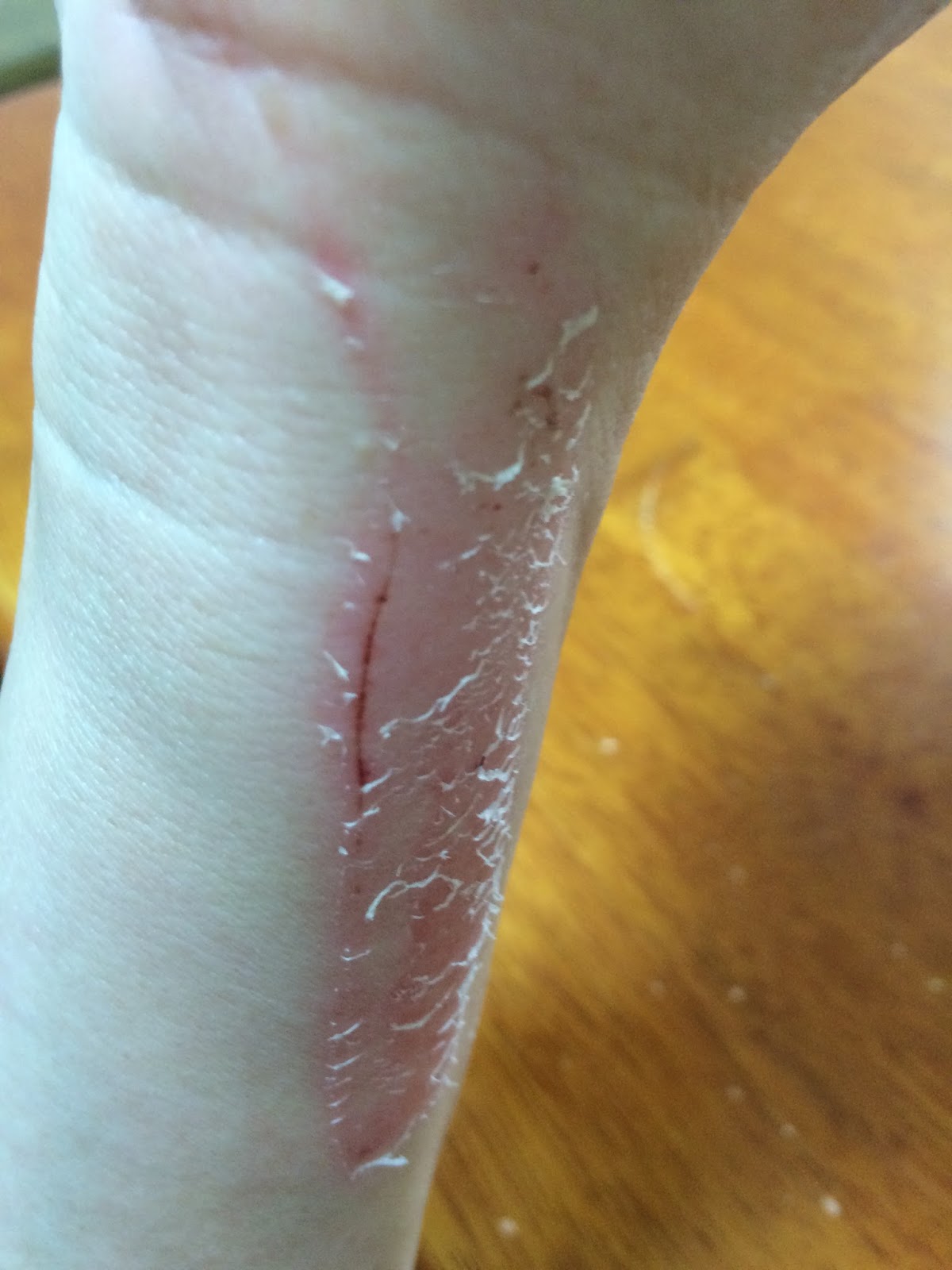 リストカットか 転落の朝 低レベルの国防論 夏の夜 絶品の茄子