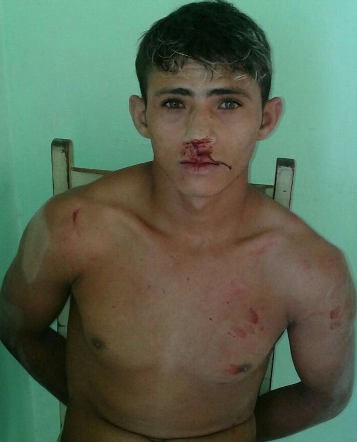 Lindomar Rodrigues: Irmão mata o outro com golpes de cambitos em Tarrafas  (CE)