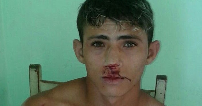 Lindomar Rodrigues: Irmão mata o outro com golpes de cambitos em Tarrafas  (CE)