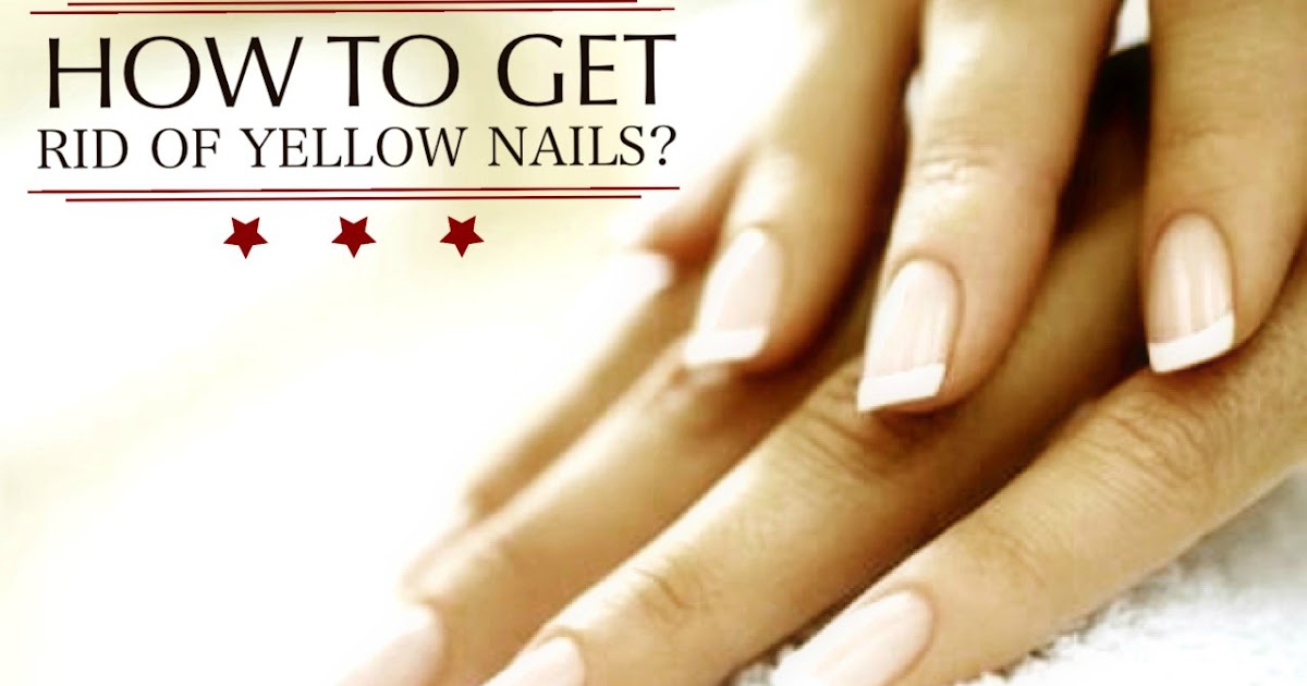How to Get Rid of Yellow Nails Quickly? Candy Crow