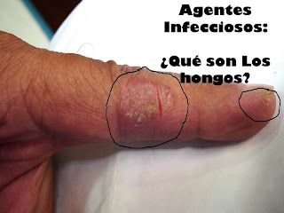 Agentes-infecciosos-los-hongos-Qué-son-los-hongos-Principales-características-de-los-hongos