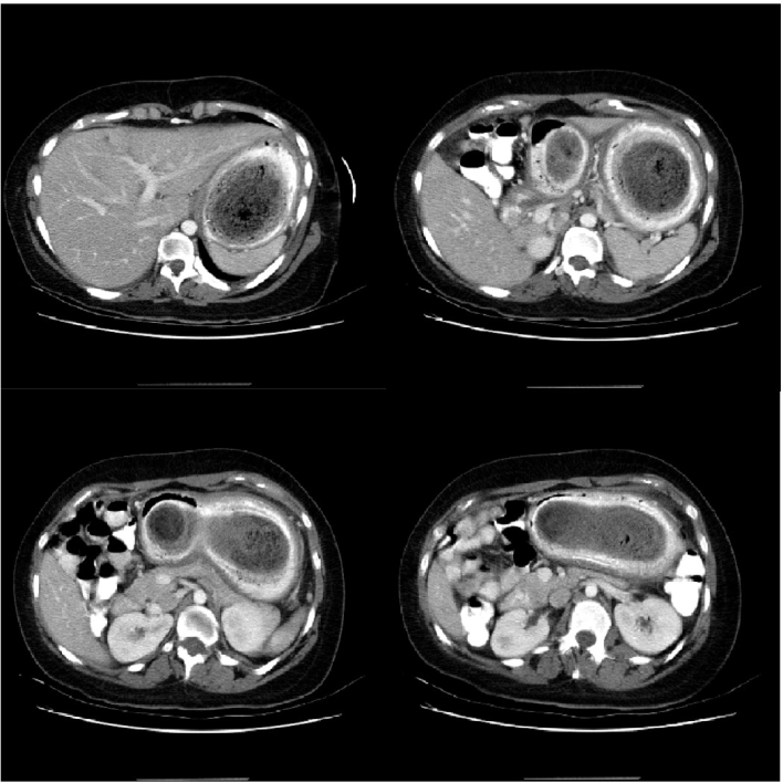 CT Scans All You Need To Know Advantages and Disadvantages involved