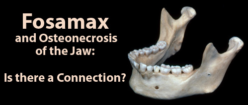 how does fosamax affect the jaw