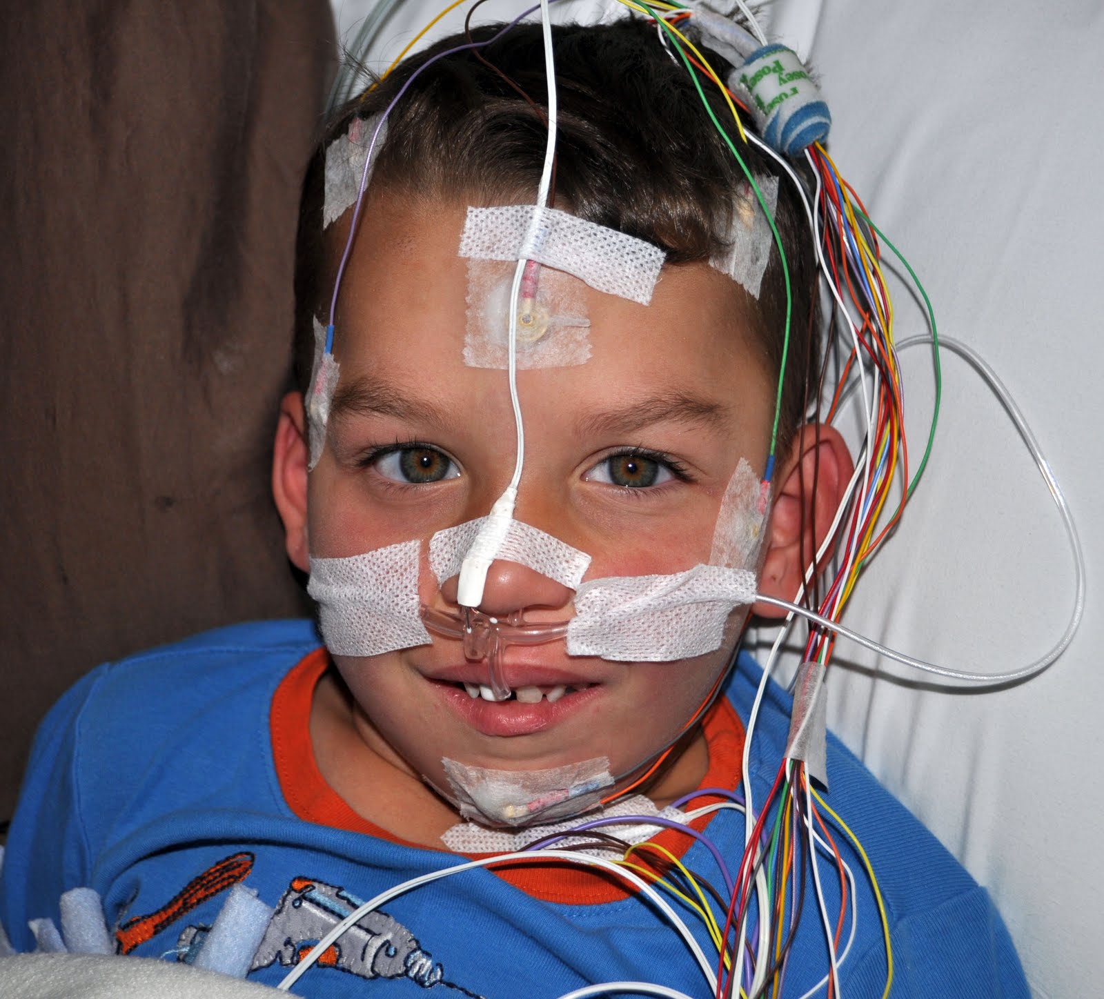 The Akins Sleep Study/ Cranial Facial Update