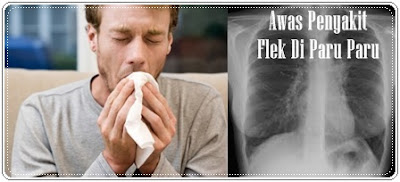 Pengobatan Tradisional Flek Di Paru Paru Terbaru | Pengobatan Tradisional Paru Paru Basah