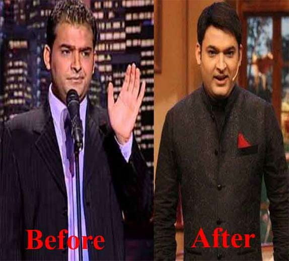 Satyam Hair Transplant in India Blog: Celebrity Hair Transplant Kapil