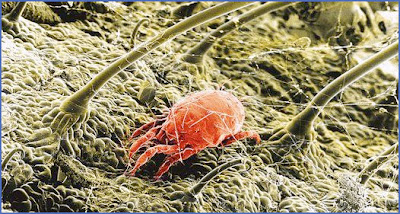 dust-mite-body-hair.jpg