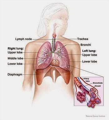 Poster Gangguan Sistem Pernapasan Lakaran