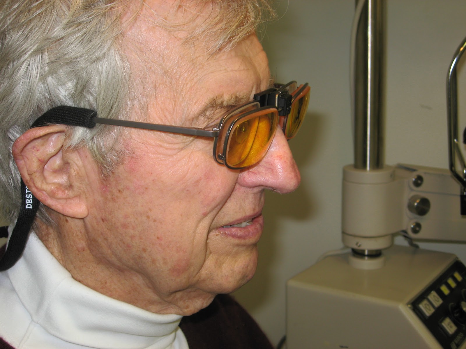 Low Vision Eyeglasses Connecticut Eye Doctor Uses EScoop Glasses