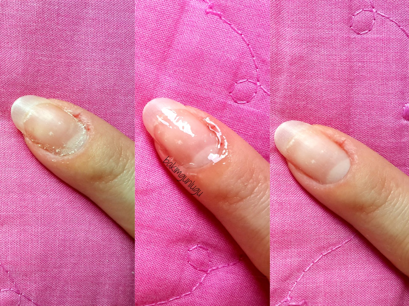 bakimgunlugu Manikür yardımcılarım 2 Kalyon Tırnak ve Tırnak Eti