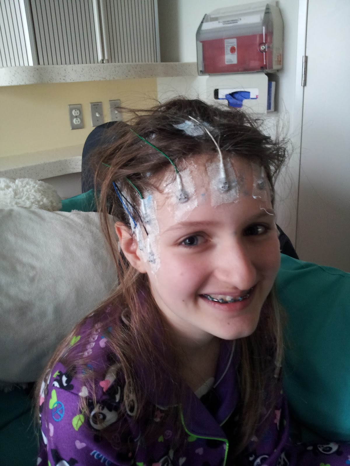 Our journey through epilepsy EEG Monitoring