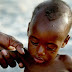 Lima juta anak di Afrika Utara mengalami kekurangan gizi aku