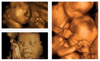 4 boyutlu ultrason nasıl olur? 4d ultrasound