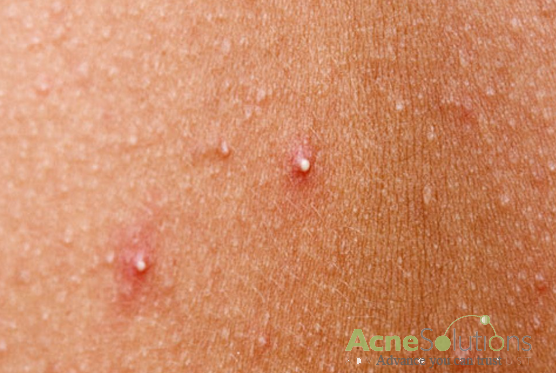 [Image: 2015-01-30_160702.png]