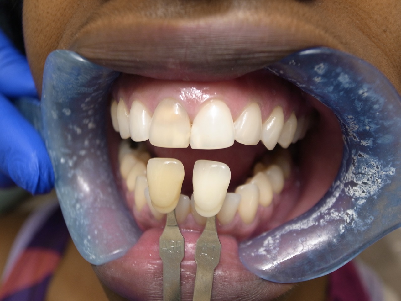 Dental Clinical Case Presentations StepbyStep guides Internal