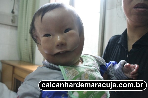 Calcanhar De Maracuja