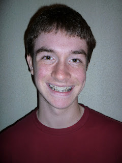 "After picture" with Dawson's new braces.