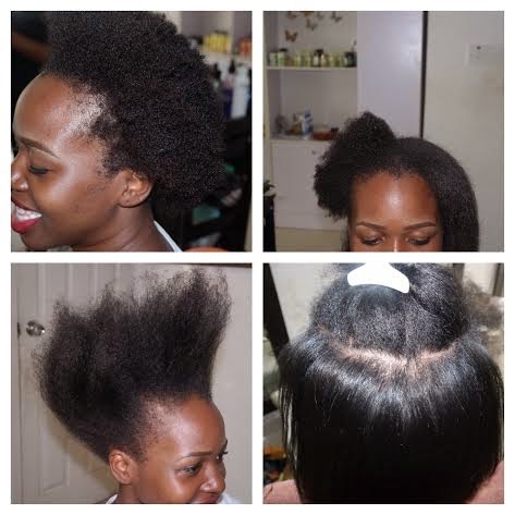 Kl S Naturals Update On Ors Strengthening And Straightening System