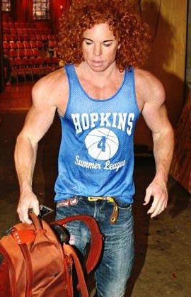 Carrot Top Plastic Surgery Before and After Facelift and Steroids