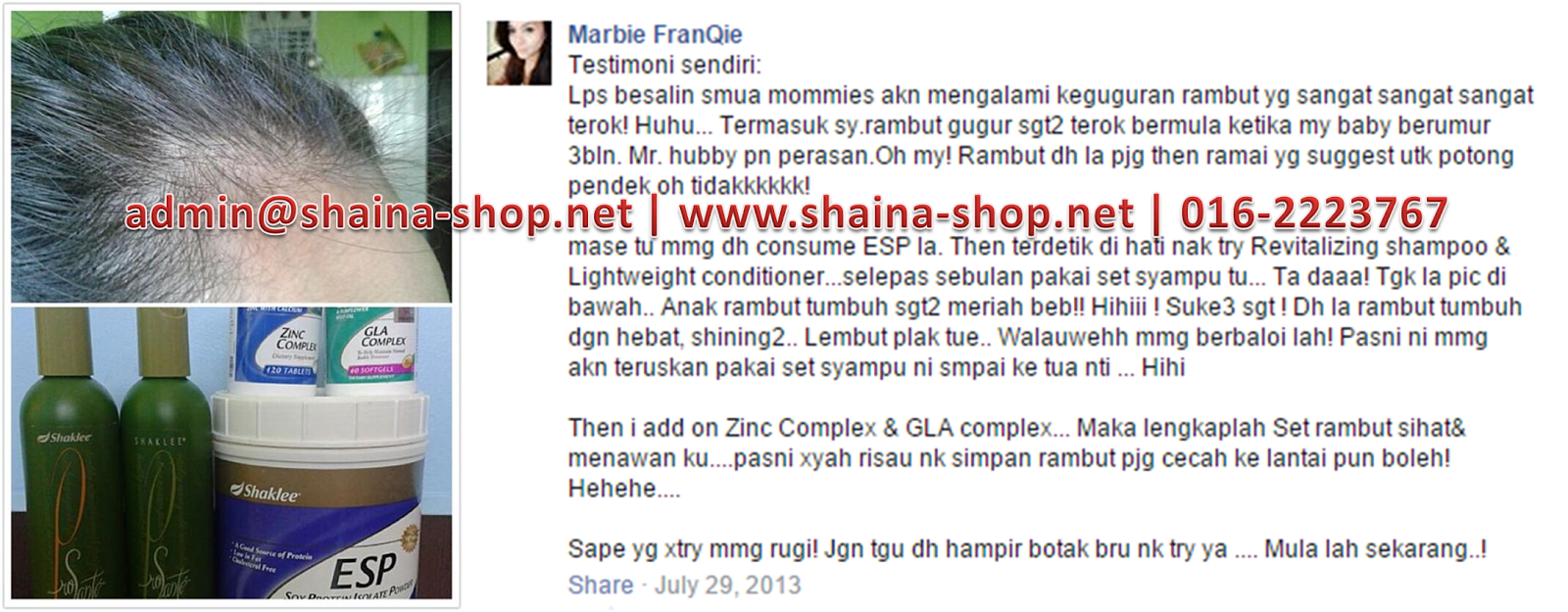 Shaklee Untuk Masalah Rambut Gugur Pengedar Shaklee Shah Alam
