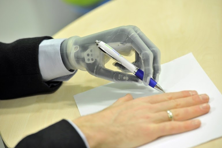 Touch Bionics prosthetic hand