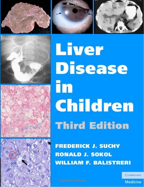 Medicine Liver disease in children