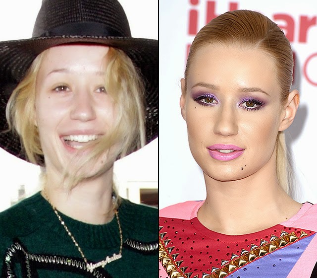 to Jennifer Idada�s Blog IGGY AZALEA QUITS SOCIAL MEDIA!
