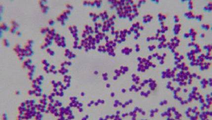 gram positive cocci in clusters gram positive cocci in clusters