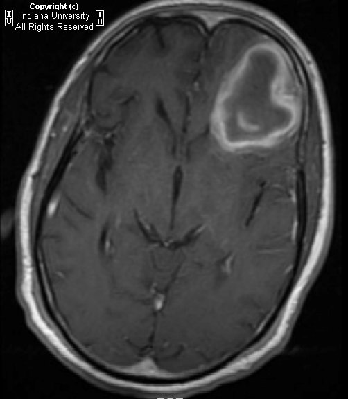 ct head axial annotated