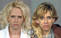 Άνθρωποι πριν και μετά την χρήση ναρκωτικών - Ανατριχιαστικές φωτό !