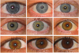 Color of Eyes May Affect Risk of Skin Conditions Like Melanoma and Vitiligo