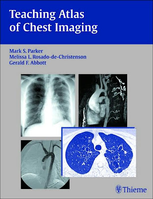 Teaching Atlas of Chest Imaging 